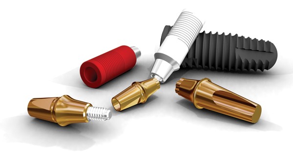 ClearChoice Dental Implants and Alternatives: What You Need to Know