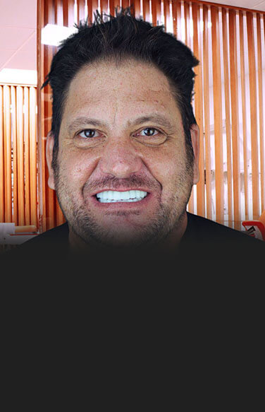 middle-aged man smile after implants in Tijuana