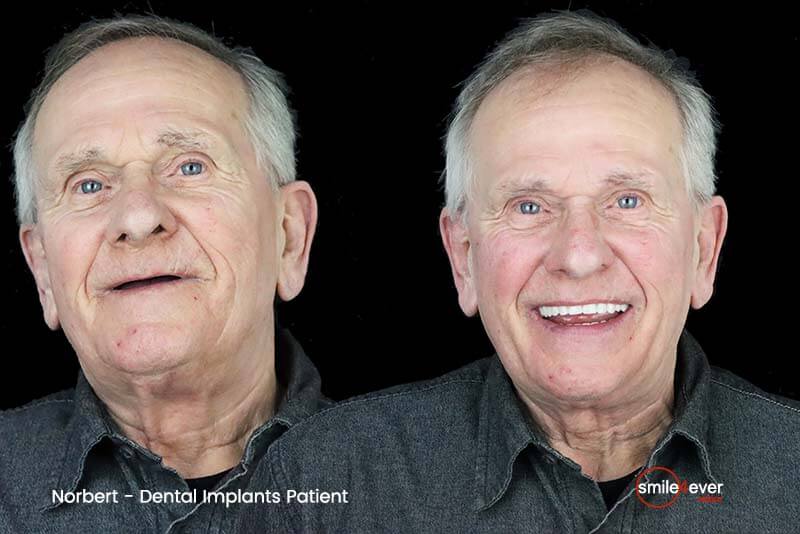 senior man after full mouth dental restoration Tijuana