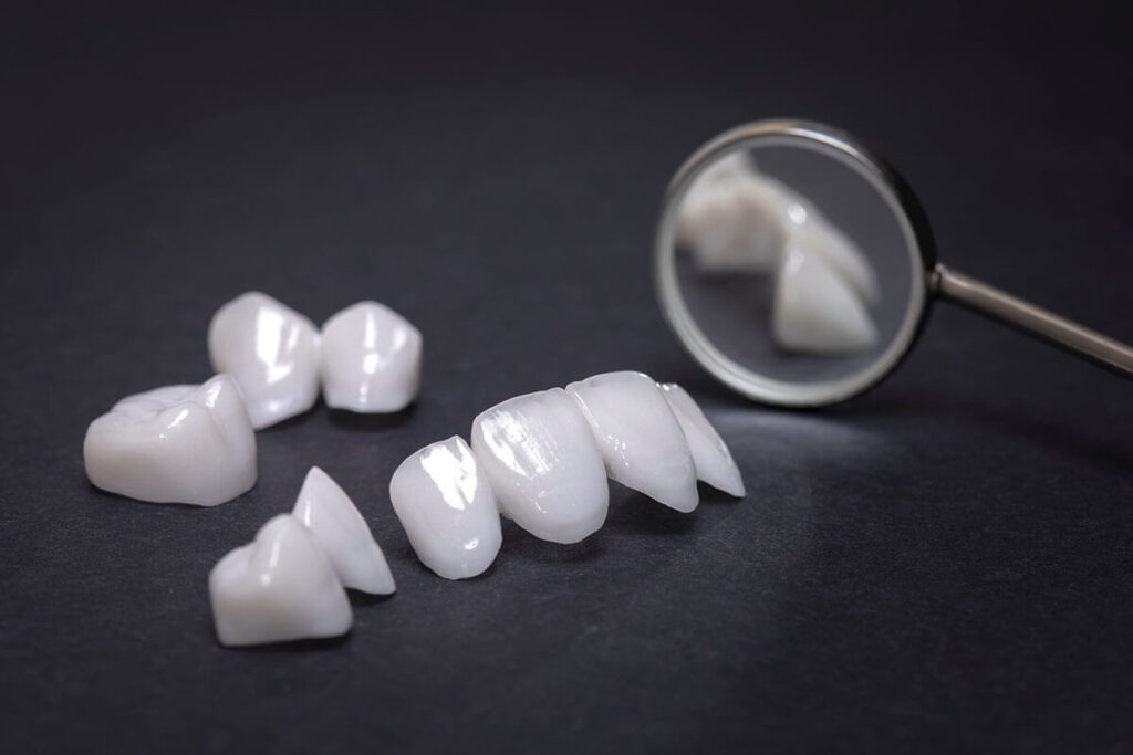 ej of dental veneers in tijuana