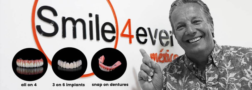 full mouth dental implant restoration options
