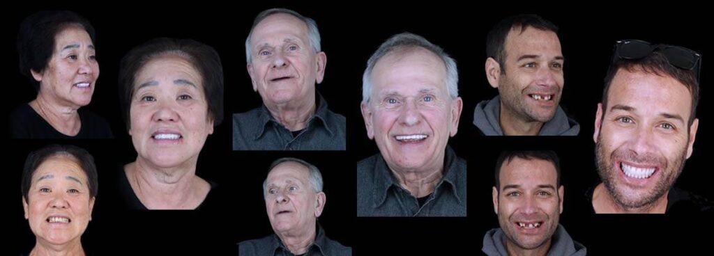 full mouth reconstruction near me