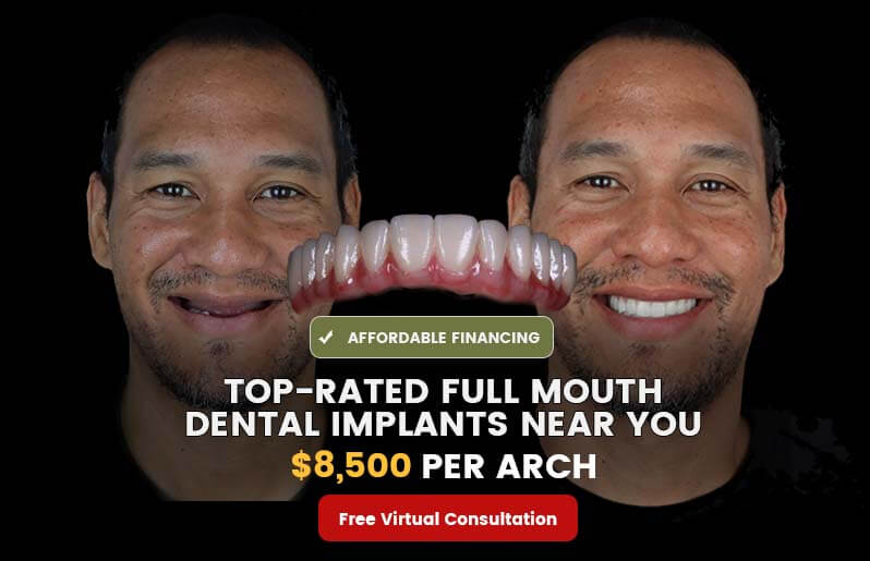 best tijuana dentist prices