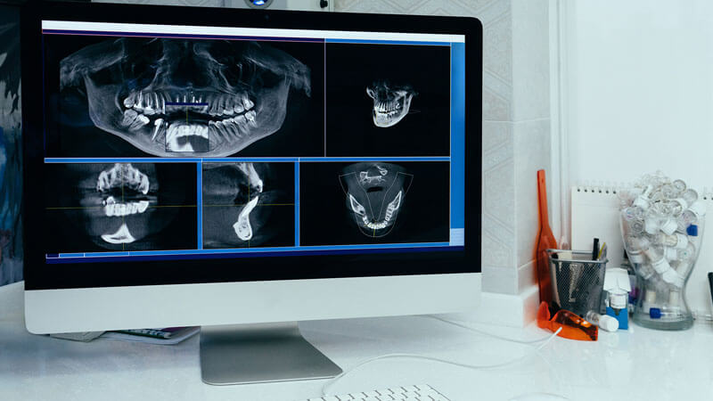 3d ct scan in Tijuana