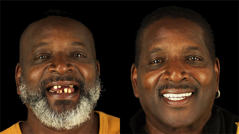 smile design dentistry reviews​
