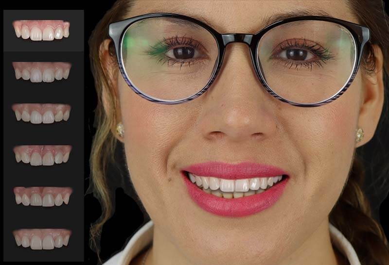 smile design dentistry & implant center