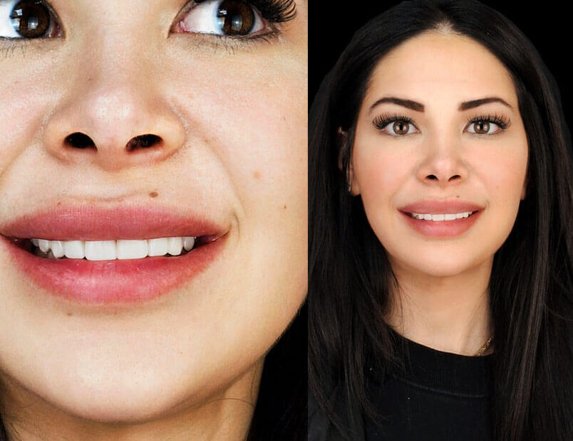 cosmetic dental services after treatment review