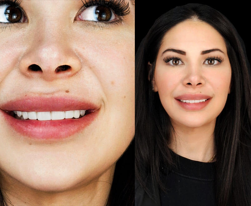 cosmetic dental services after treatment review