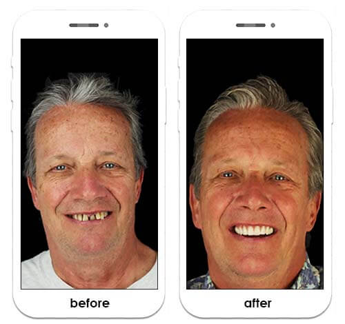 Tijuana dentist reviews from real patients