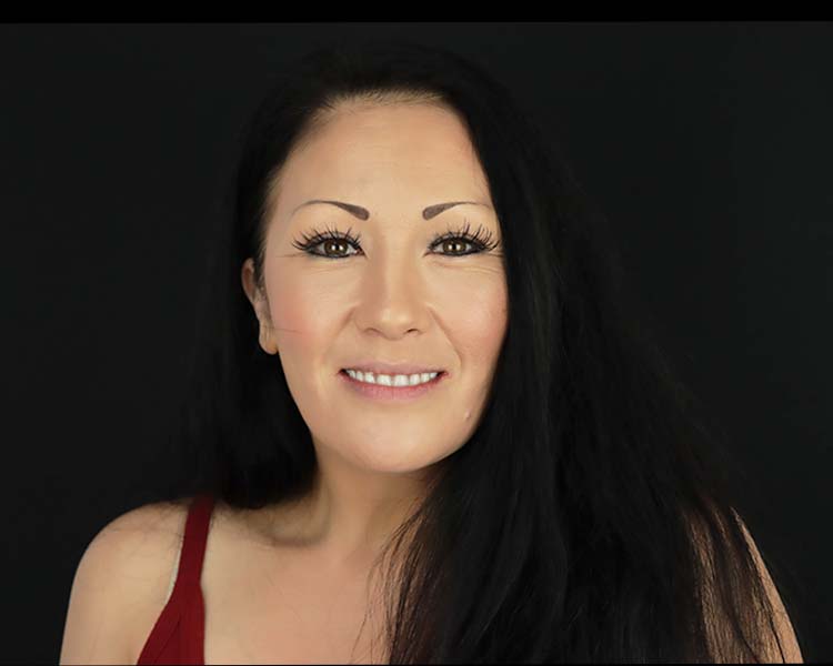 all on 6 dental implants mexico patient before after