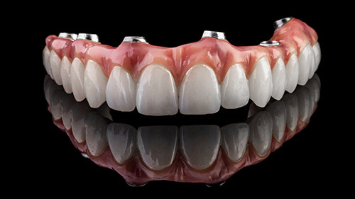 Dental implants Tijuana cost from tijuanadentalcenter.com